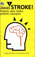 Awas Stroke : Pengertian, Gejala, Tindakan, Perawatan & Pencegahan