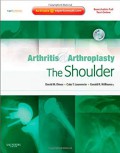 Arthritis & arthroplasty : the shoulder