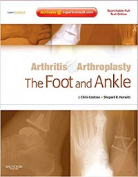 Arthritis & arthroplasty : the foot and ankle