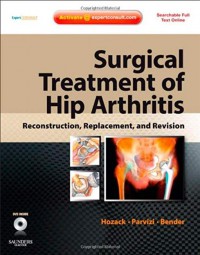 Surgical treatment of hip arthritis : reconstruction, replacement, and revision