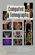 Computed tomography